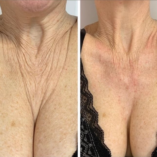 Crème raffermissante cou et décolleté