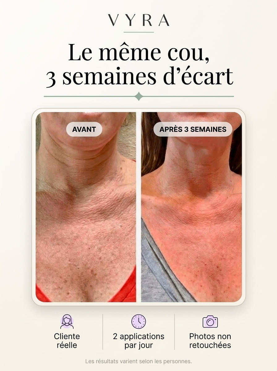 Crème raffermissante cou et décolleté