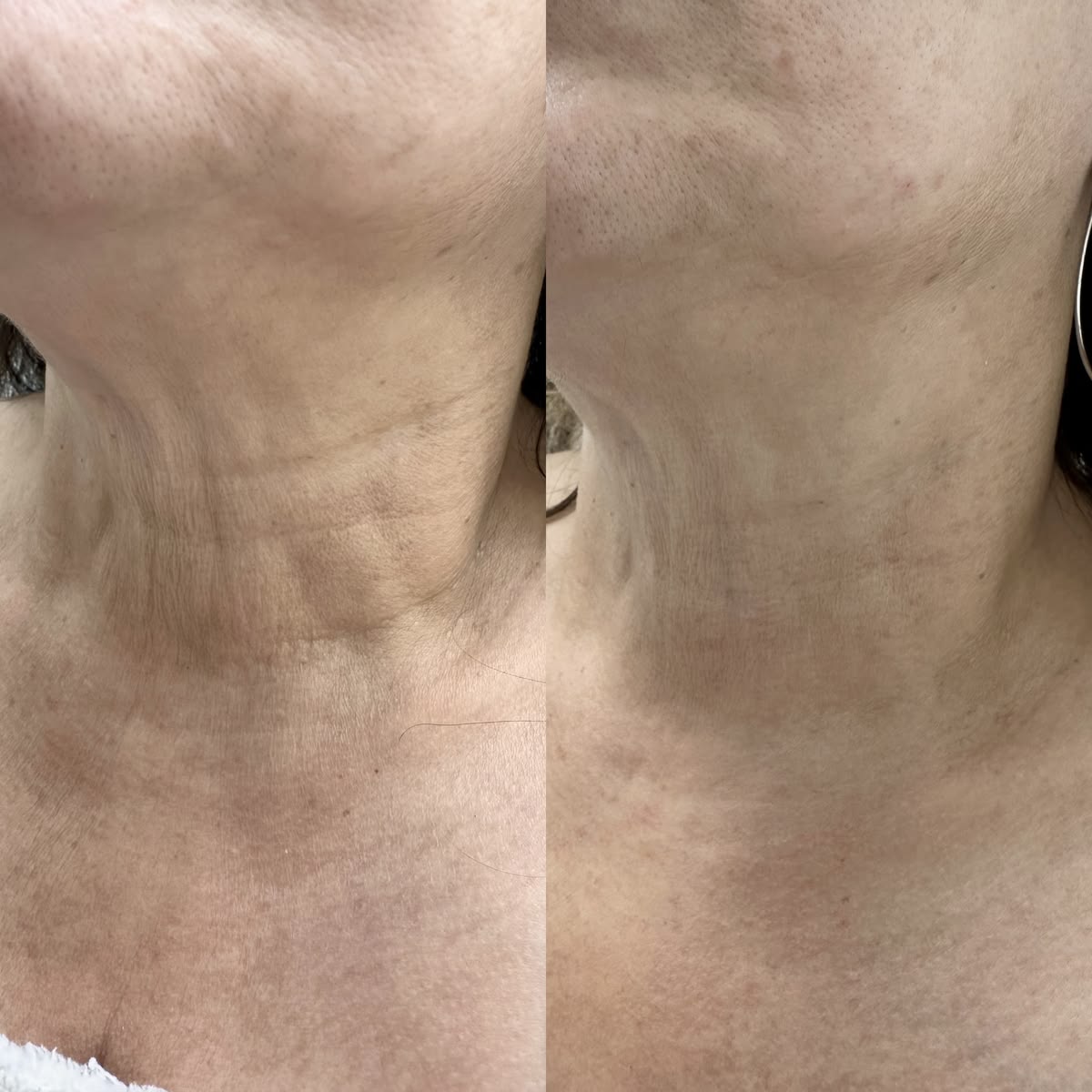 Crème raffermissante cou et décolleté